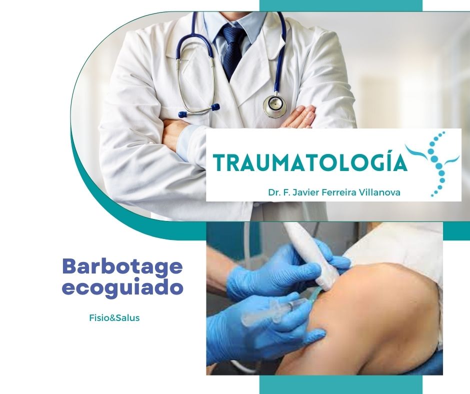 Barbotage Ecoguiado de Tendinitis Calcificante de Hombro