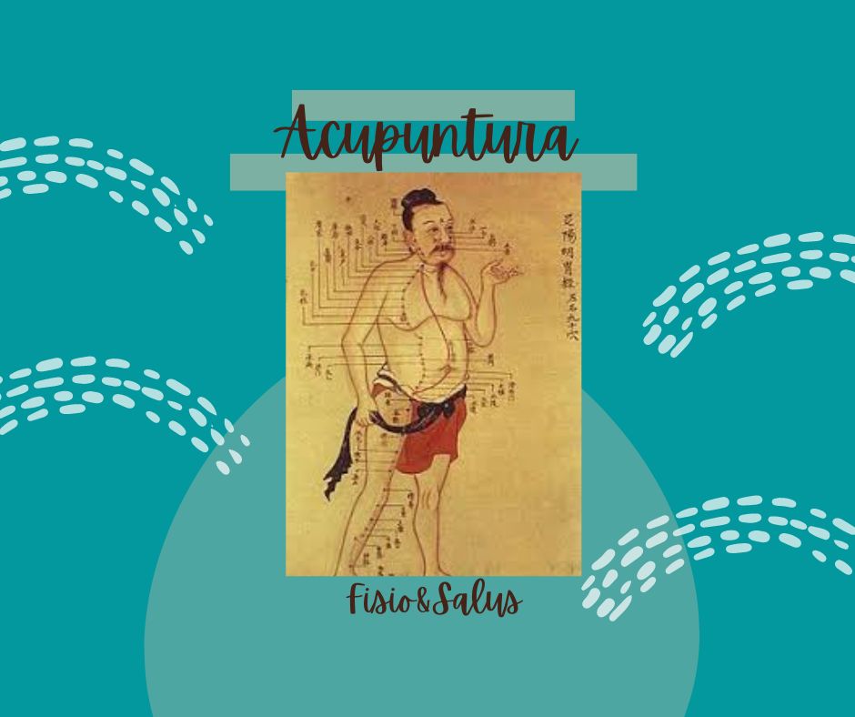 Acupuntura